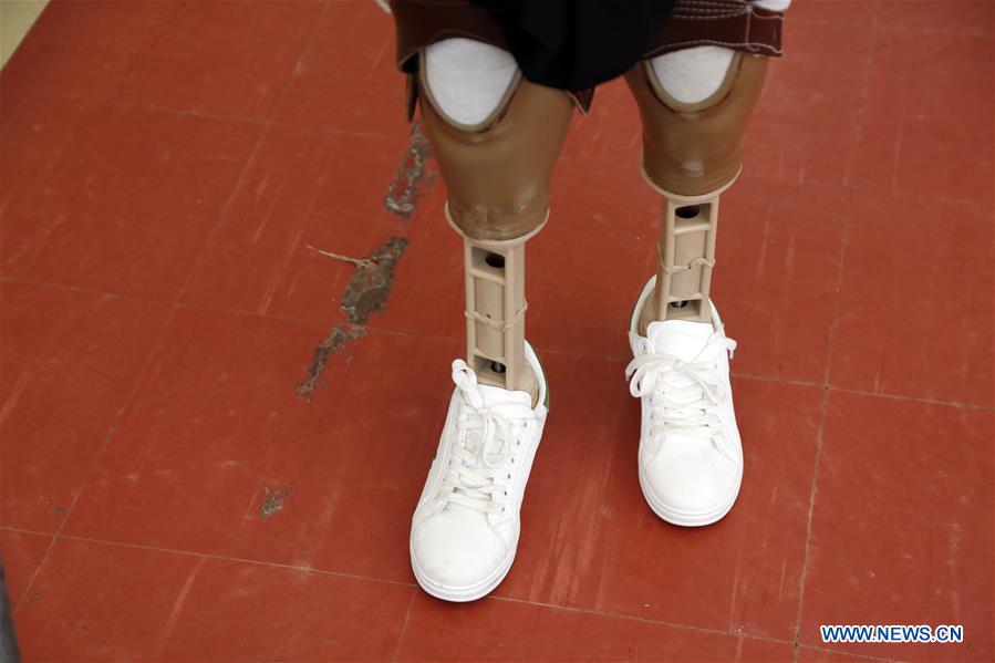 YEMEN-SANAA-LANDMINES-VICTIMS