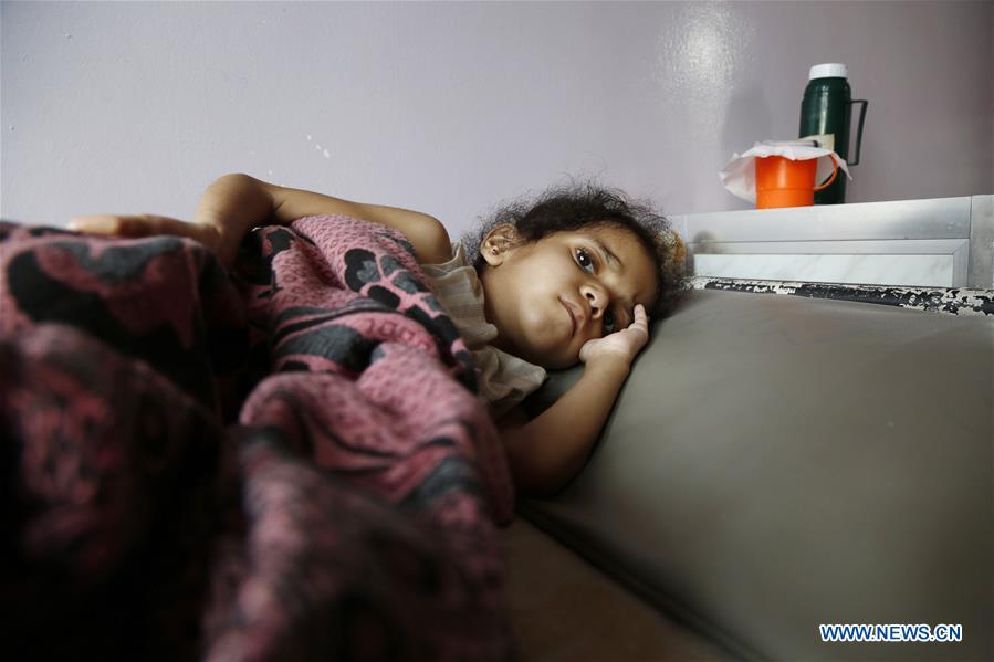 YEMEN-SANAA-CHILDREN-MALNUTRITION