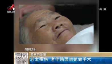 最真的愛情:老太摔傷 老伴貼面哄她做手術(shù)