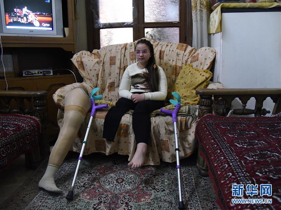 （國際&middot;圖文互動(dòng)）（1）通訊：戰(zhàn)爭(zhēng)給他們留下殘缺的童年&mdash;&mdash;敘利亞危機(jī)9周年記